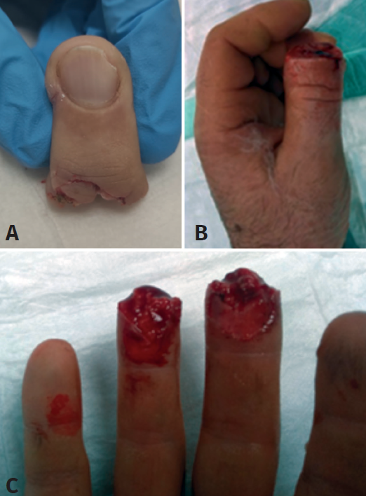 title texto alternativo